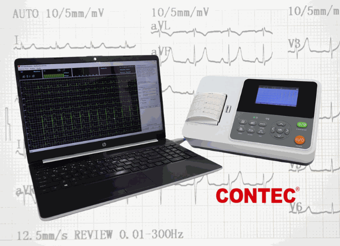 Electrocardiografo: pantalla LCD a color donde se muestra el pre-registro del estudio, ahorrando tiempo y dinero al reducir impresiones premuestreo.