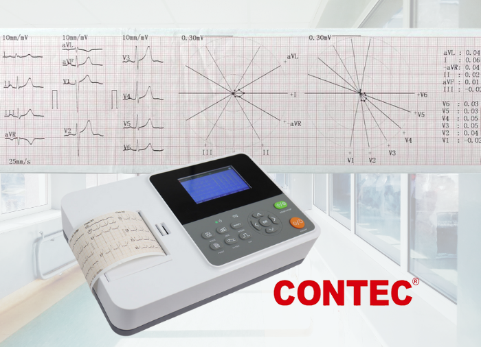 Electrocardiografo: fácil de usar, con diseño elegante que tiene las capacidades de cumplir los requerimientos de un estudio de la función cardíaca en múltiples entornos.