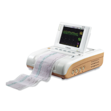 Monitor Fetal: Impresión de línea de ancho de 112 mm incorporada para uso clínico. Contenedor de papel ubicado directamente en el frente para facilitar la carga del papel y una mejor visibilidad.